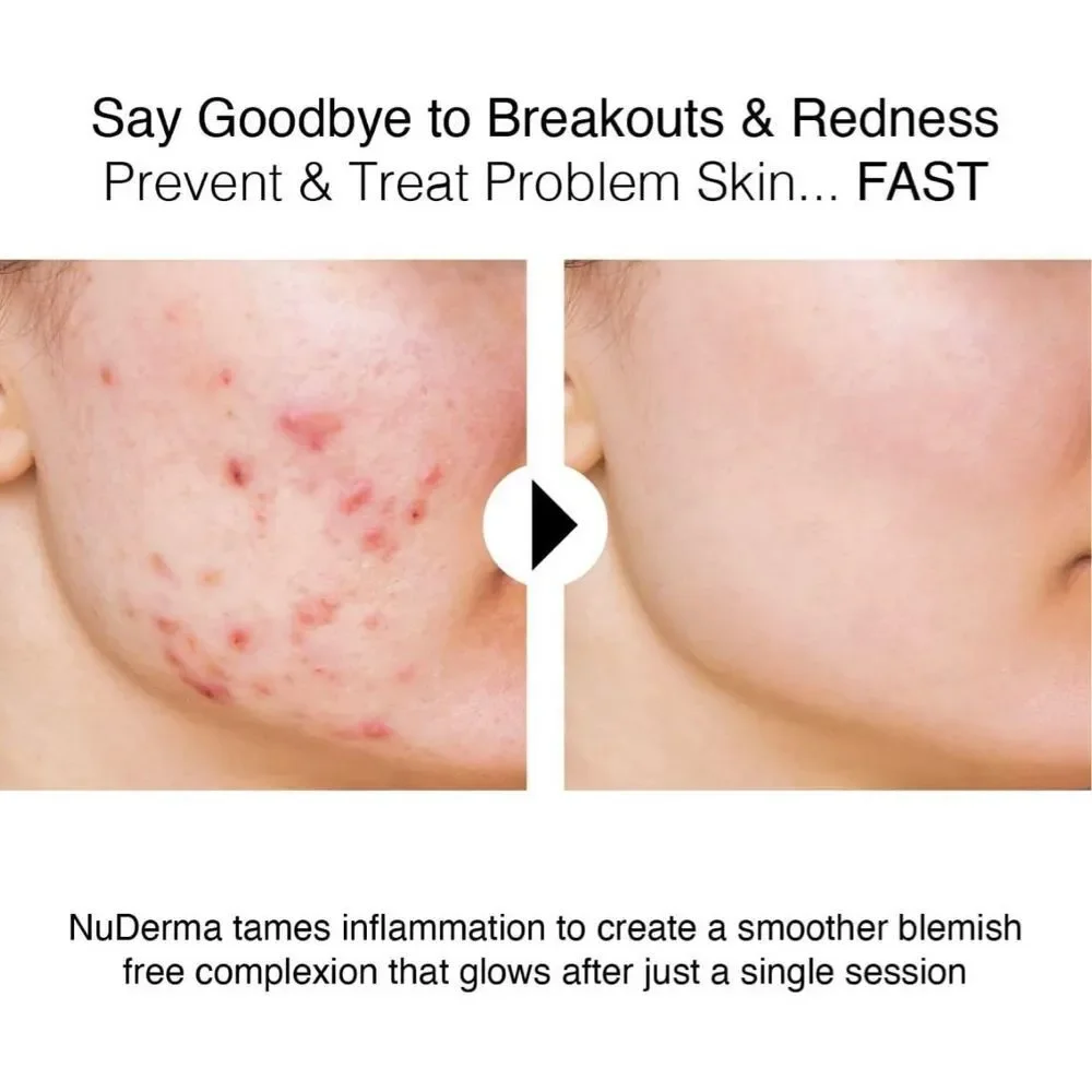 Nuderma barely used